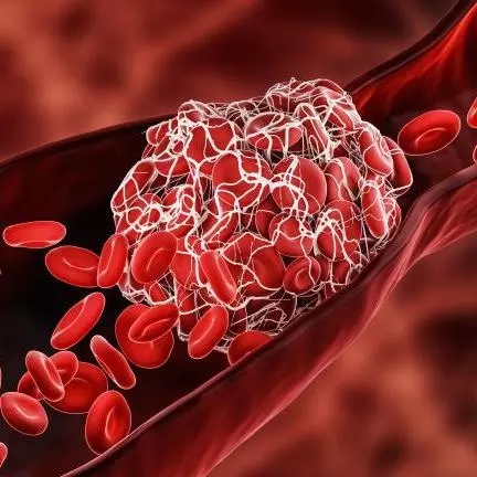 antiphospholipid syndrome is an autoimmune disorder