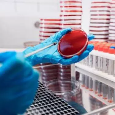 Blood to Bact Test, Culture Report in 24 Hours, Quick Culture Test, Cost of Blood to Bact Test at Maurya Labs, Test for Sepsis