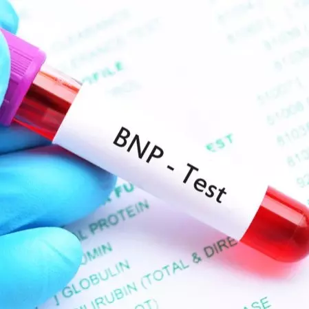 Natriuretic Peptide Test, BNP Test, Best test for heart failure, Cost of BNP Test at Maurya Labs