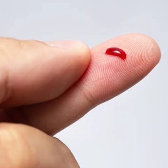 BT CT Test, Bleeding Time Test, Clotting Time Test, Cost of BT CT Test at NABL Certified Maurya Labs
