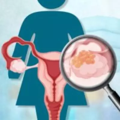 Ca 125 Test, Test for Ovarian Cancer, Cost of Ca 125 at Maurya Labs