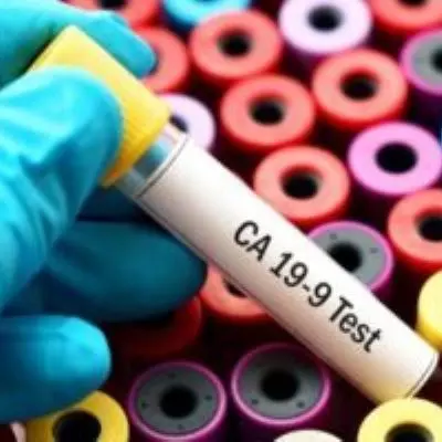 cbc test is done on fully automatic 6 part hemoanalyzer from japan