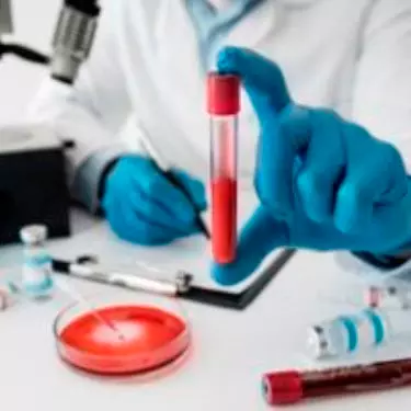 CEA Test at Maurya Labs, Cost of CEA Test, Carcinoembryonic Antigent, Test for Cancer