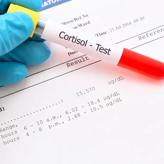 Cortisol Test at Maurya Labs, Best test for Addison's and Cushing Syndrome, Cost of Cortisol Test, NABL Certified Pathology Lab