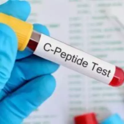 C Peptide Test, Cost of C Peptide Test at Maurya Labs, Test for Type 1 or 2 Diabetes