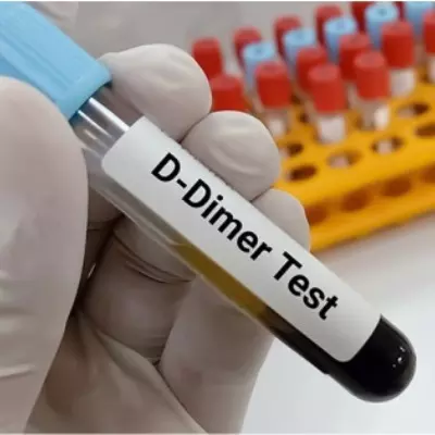 cbc test is done on fully automatic 6 part hemoanalyzer from japan