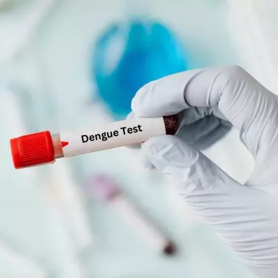 Dengue Test, Dengue NS1 Test, Dengue IgG and IgM Test, Cost of Dengue Test at Maurya Labs, NABL Certified Lab